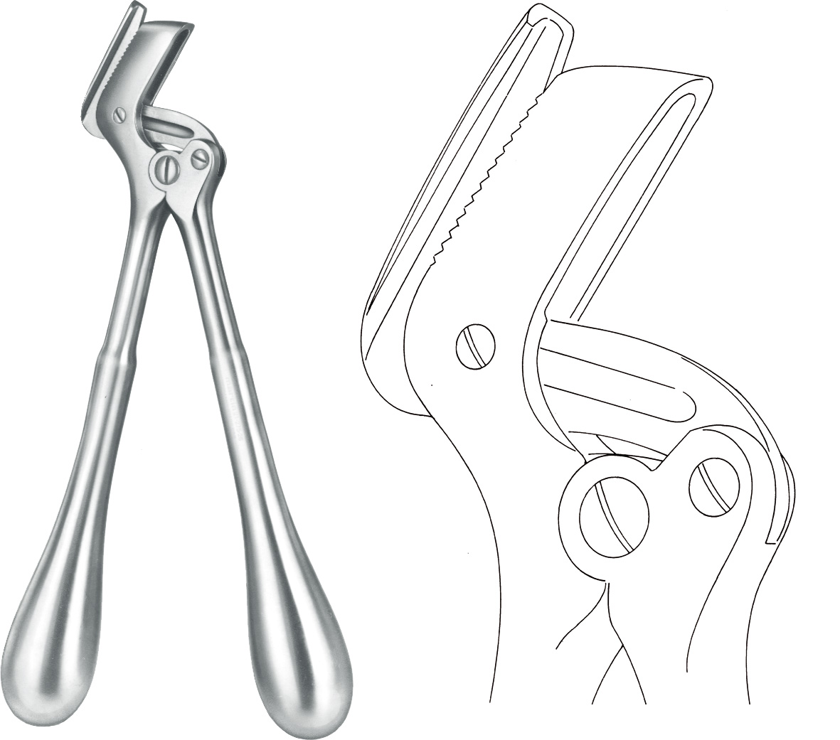 Plaster shears, acc. to Stille, model "Martin"